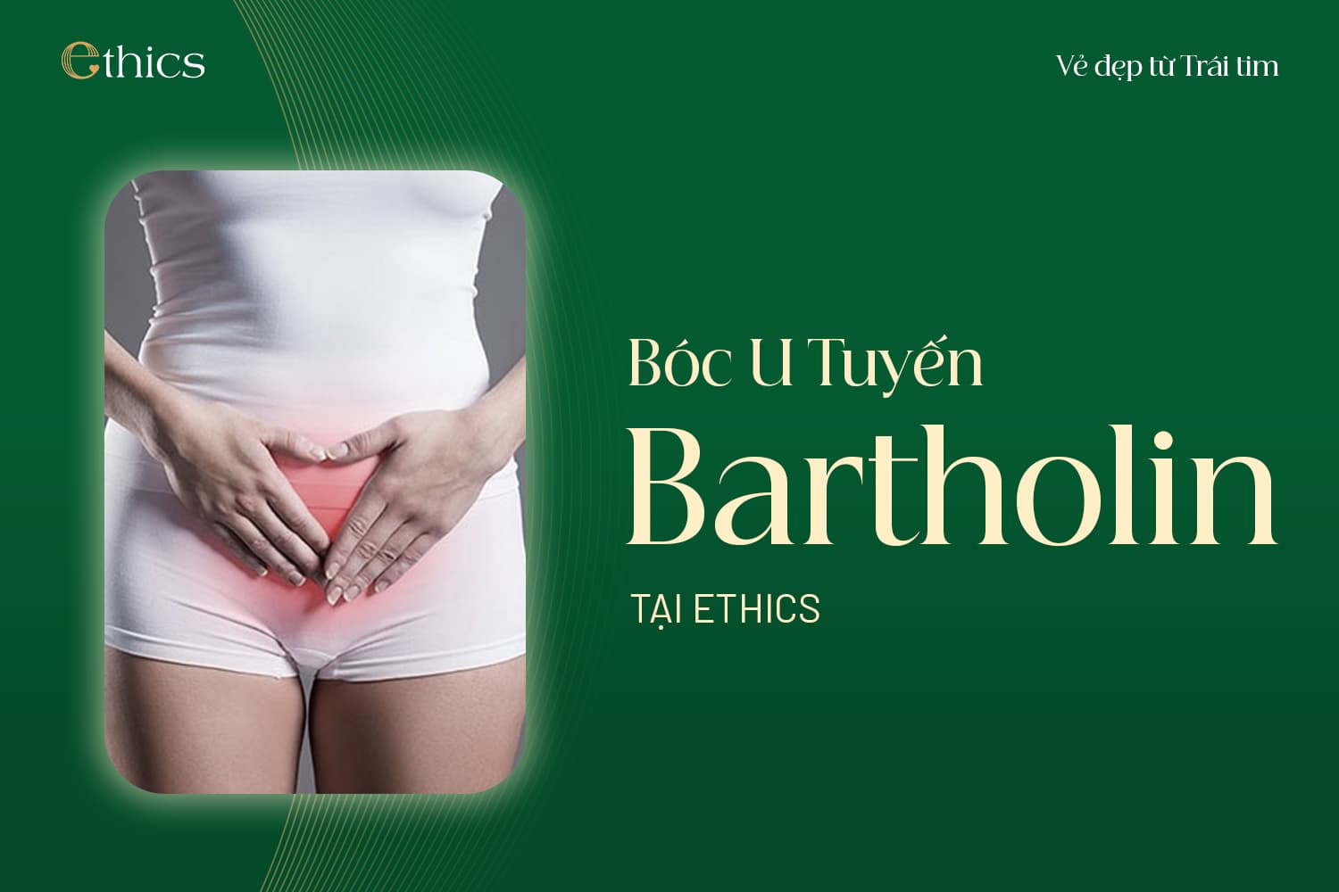 Bartholin-Drüsenzyste entfernen