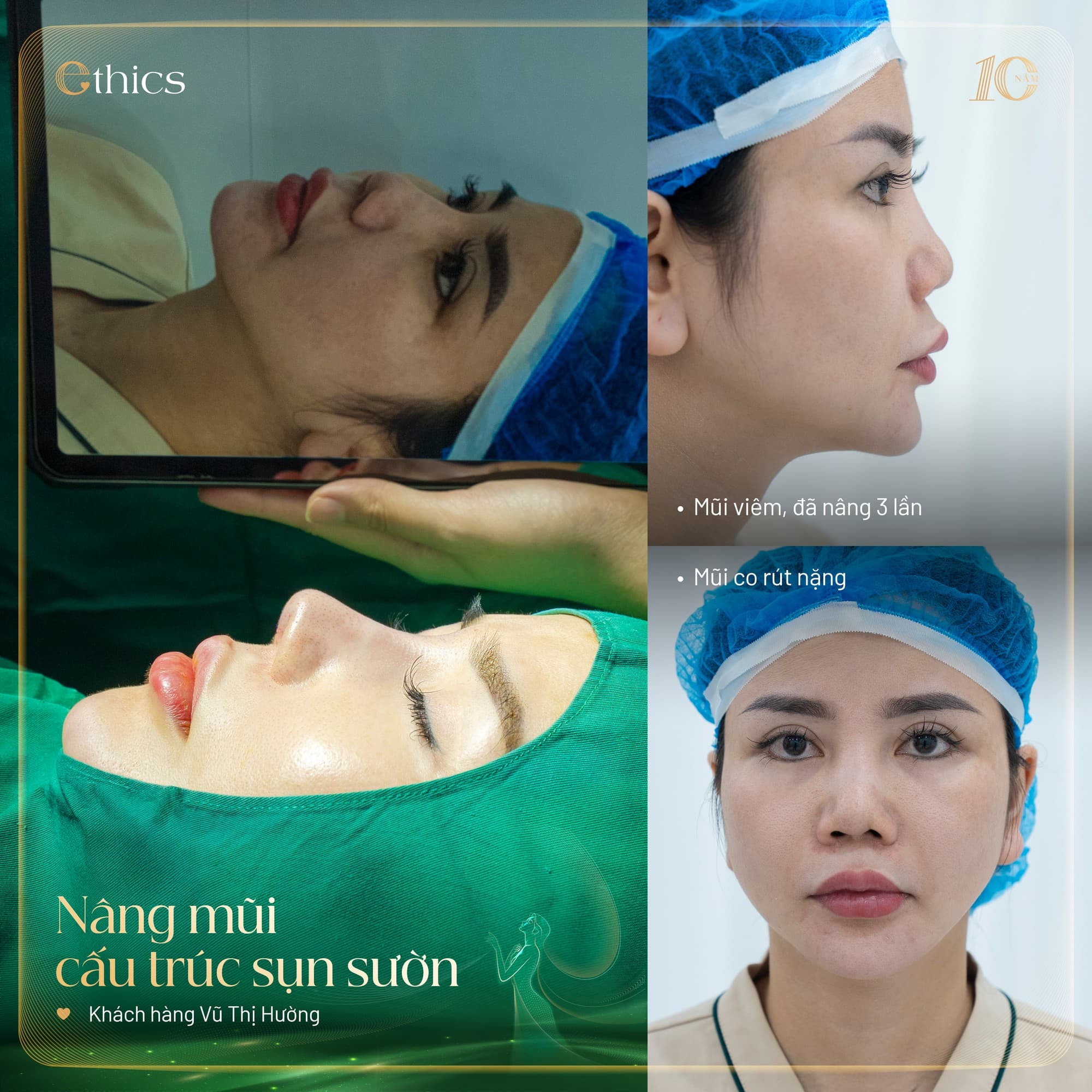 Knorpeltransplantation